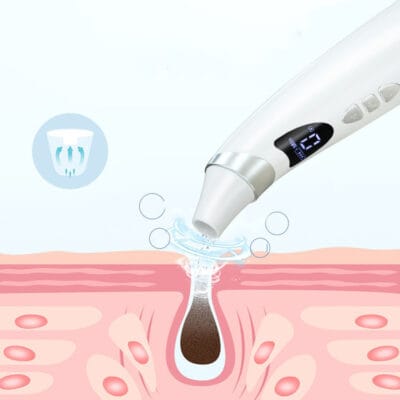 Blackhead Suction - Image 2