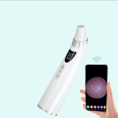 Blackhead Suction - Image 3