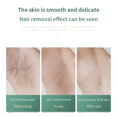 Painless Laser Epilator - Image 6