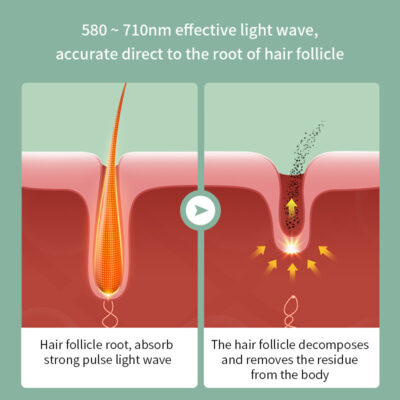 Painless Laser Epilator - Image 4